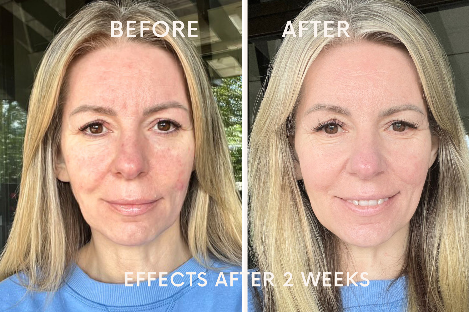 Before - After 2 Weeks Comparison Effekt