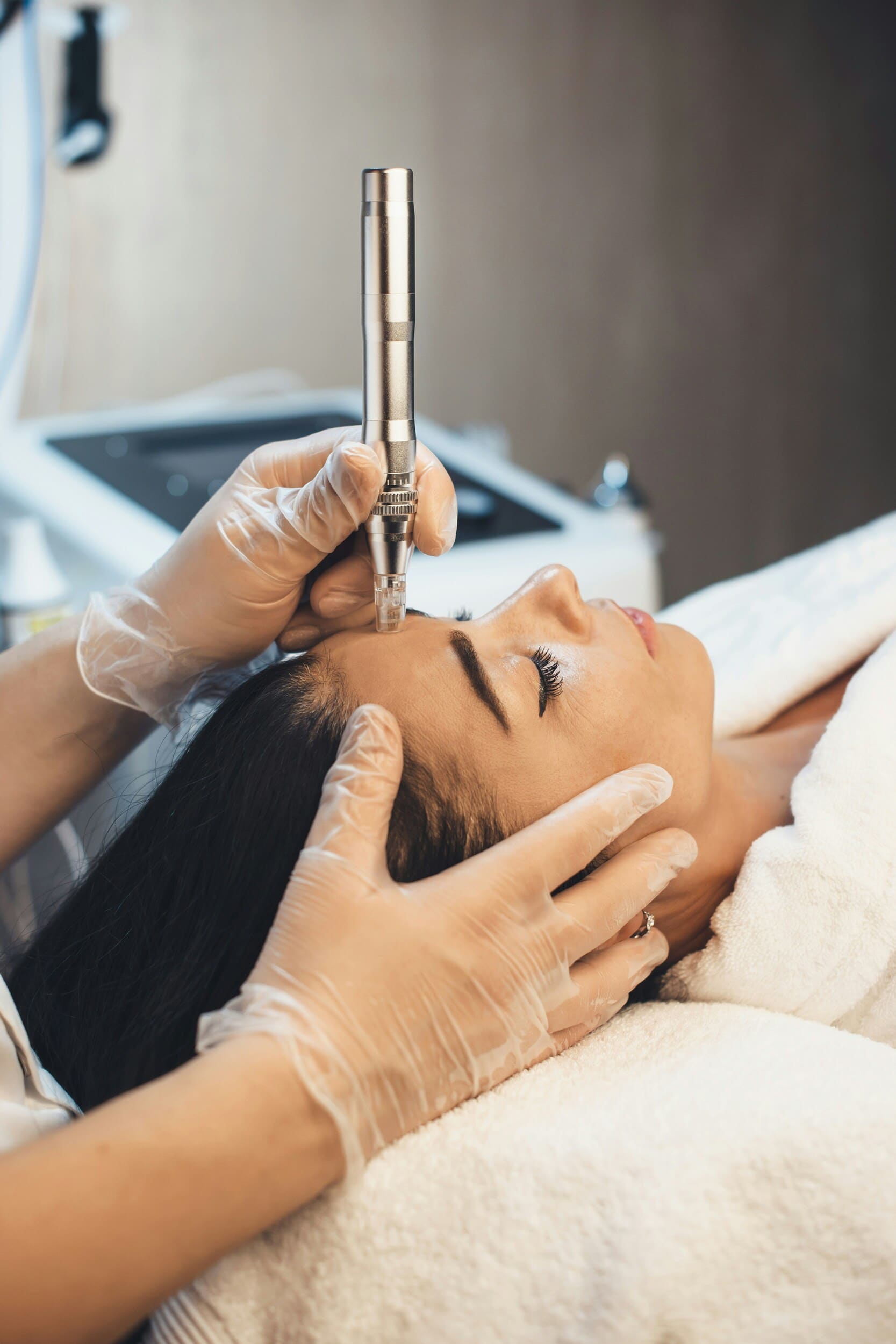 Radiofrequenz-Microneedling: Klinik-Systeme, Heimgeräte & was die Wissenschaft sagt