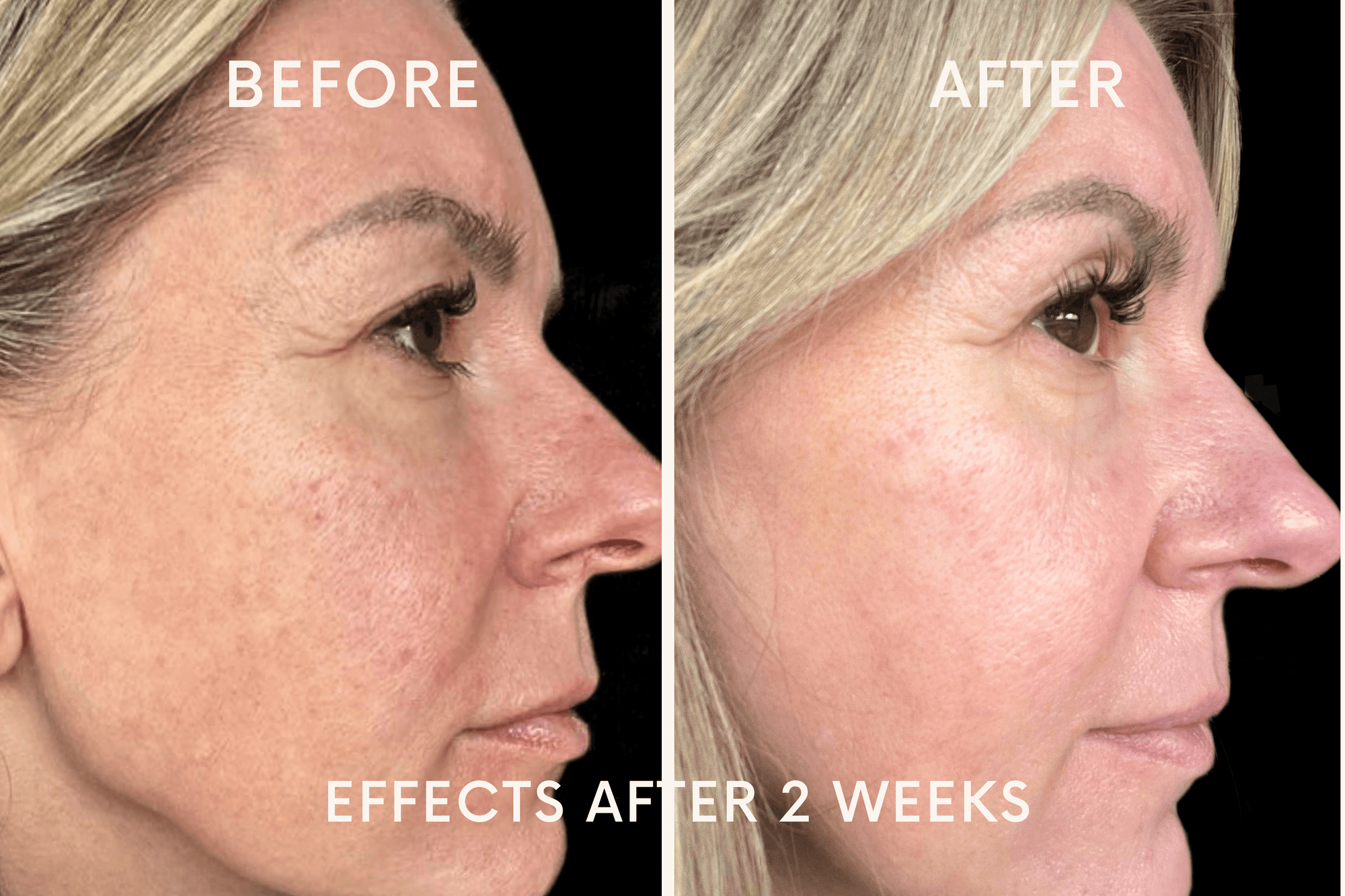 Study Model Effects after 2 weeks Image 2