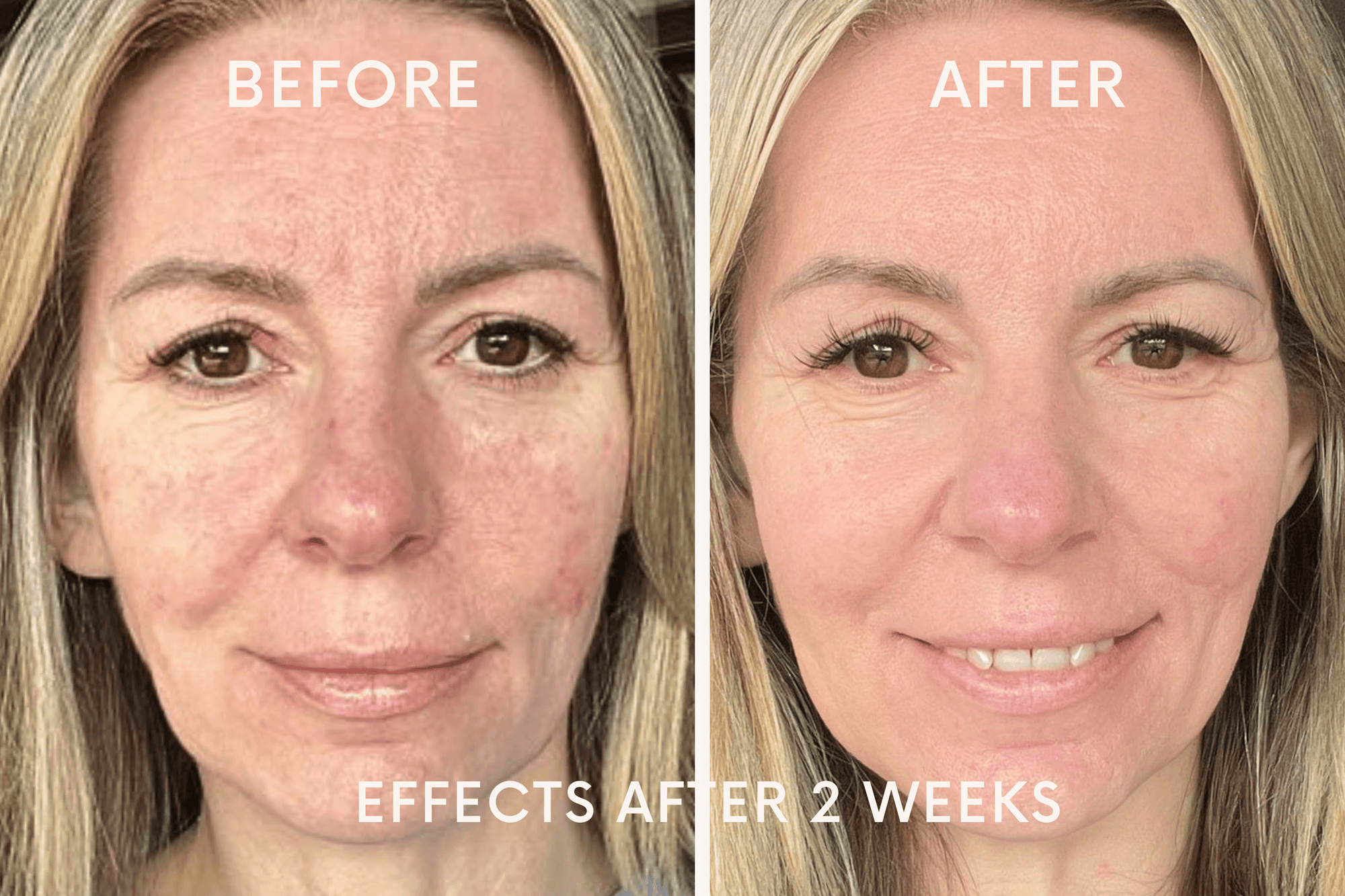 Study Model Effects after 2 weeks Image 1